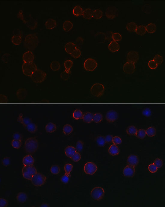 Immunofluorescence analysis of SP2/0 cells using TNFRSF17 Polyclonal Antibody at dilution of 1:100 (40x lens). Blue: DAPI for nuclear staining.