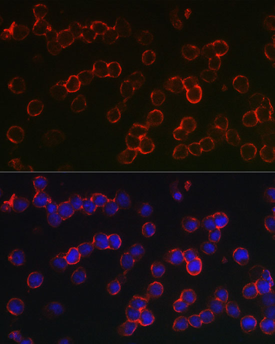 Immunofluorescence analysis of U-937 cells using TNFRSF17 Polyclonal Antibody at dilution of 1:100 (40x lens). Blue: DAPI for nuclear staining.