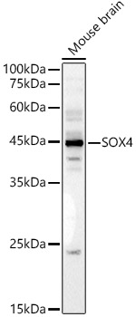 Western blot analysis of Mouse brain using SOX4 Polyclonal Antibody at 1:2000 dilution.