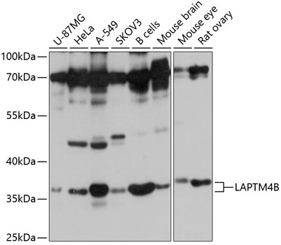 Western blot analysis of extracts of various cell lines using LAPTM4B Polyclonal Antibody at 1:1000 dilution.