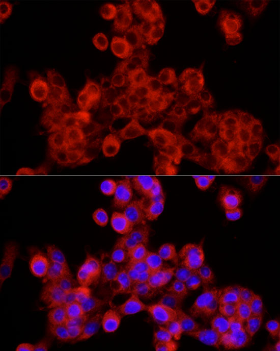 Immunofluorescence analysis of HepG2 cells using SEC24C Polyclonal Antibody at dilution of 1:100 (40x lens). Blue: DAPI for nuclear staining.