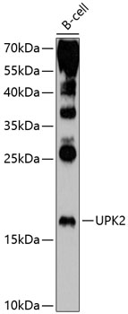 Western blot analysis of extracts of B-cell cells using UPK2 Polyclonal Antibody at 1:1000 dilution.