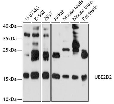 Western blot analysis of extracts of various cell lines using UBE2D2 Polyclonal Antibody at 1:1000 dilution.