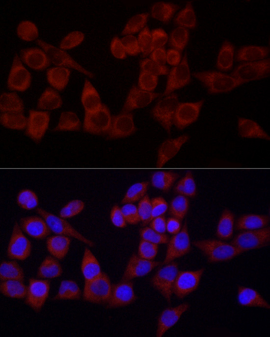 Immunofluorescence analysis of HeLa cells using SRP72 Polyclonal Antibody at dilution of 1:100 (40x lens). Blue: DAPI for nuclear staining.