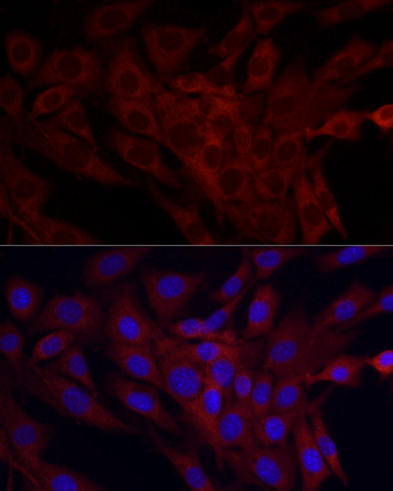 Immunofluorescence analysis of NIH/3T3 cells using SRP72 Polyclonal Antibody at dilution of 1:100 (40x lens). Blue: DAPI for nuclear staining.