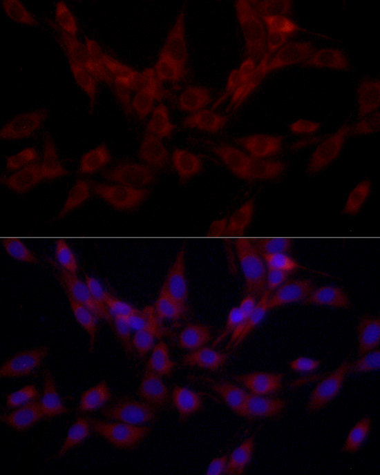 Immunofluorescence analysis of PC-12 cells using SRP72 Polyclonal Antibody at dilution of 1:100 (40x lens). Blue: DAPI for nuclear staining.