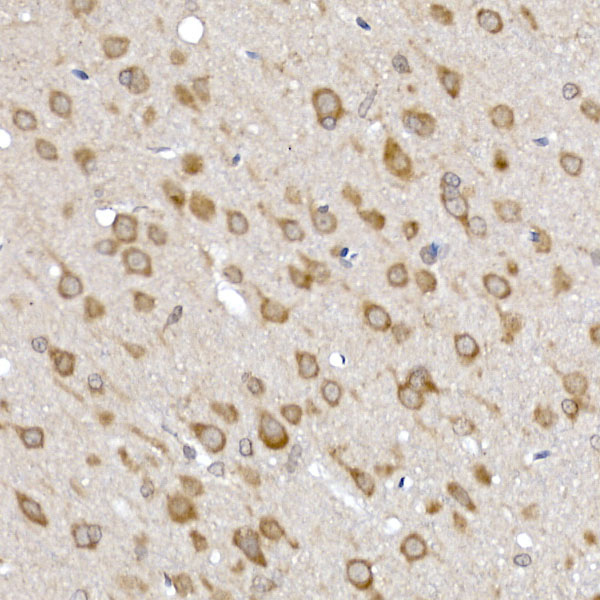 Immunohistochemistry of paraffin-embedded rat brain using SRP72 Polyclonal Antibody at dilution of 1:100 (40x lens).Perform high pressure antigen retrieval with 10 mM citrate buffer pH 6.0 before commencing with IHC staining protocol.