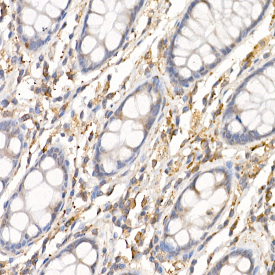 Immunohistochemistry of paraffin-embedded human colon using C19orf10 Polyclonal Antibody at dilution of 1:450 (40x lens).Perform high pressure antigen retrieval with 10 mM citrate buffer pH 6.0 before commencing with IHC staining protocol.