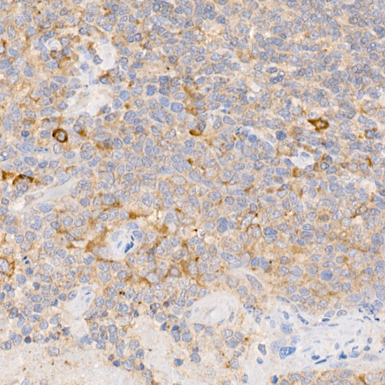 Immunohistochemistry of paraffin-embedded human tonsil using C19orf10 Polyclonal Antibody at dilution of 1:400 (40x lens).Perform high pressure antigen retrieval with 10 mM citrate buffer pH 6.0 before commencing with IHC staining protocol.