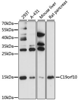 Western blot analysis of extracts of various cell lines using C19orf10 Polyclonal Antibody at 1:1000 dilution.