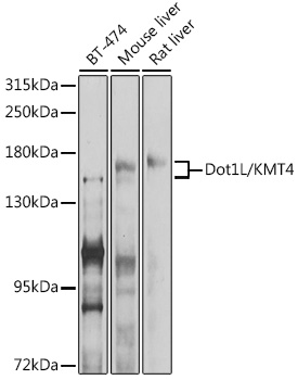 Western blot analysis of extracts of various cell lines using Dot1L/KMT4 Polyclonal Antibody at 1:1000 dilution.