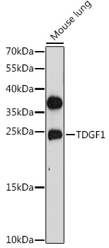 Western blot analysis of extracts of Mouse lung using TDGF1 Polyclonal Antibody at 1:1000 dilution.