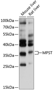 Western blot analysis of extracts of various cell lines using MPST Polyclonal Antibody at 1:1000 dilution.