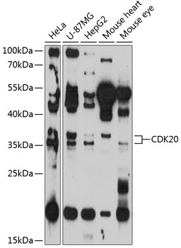 Western blot analysis of extracts of various cell lines using CDK20 Polyclonal Antibody at 1:3000 dilution.