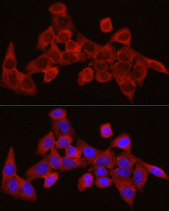 Immunofluorescence analysis of HeLa cells using SEC61A1 Polyclonal Antibody at dilution of 1:300 (40x lens). Blue: DAPI for nuclear staining.