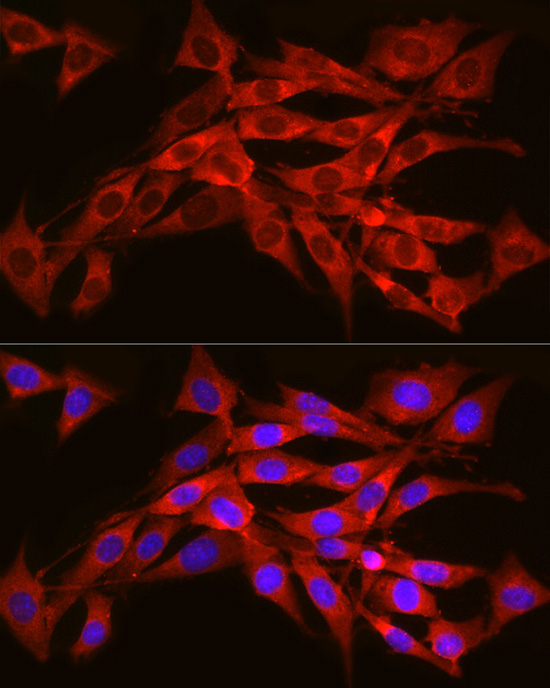 Immunofluorescence analysis of NIH/3T3 cells using SEC61A1 Polyclonal Antibody at dilution of 1:300 (40x lens). Blue: DAPI for nuclear staining.