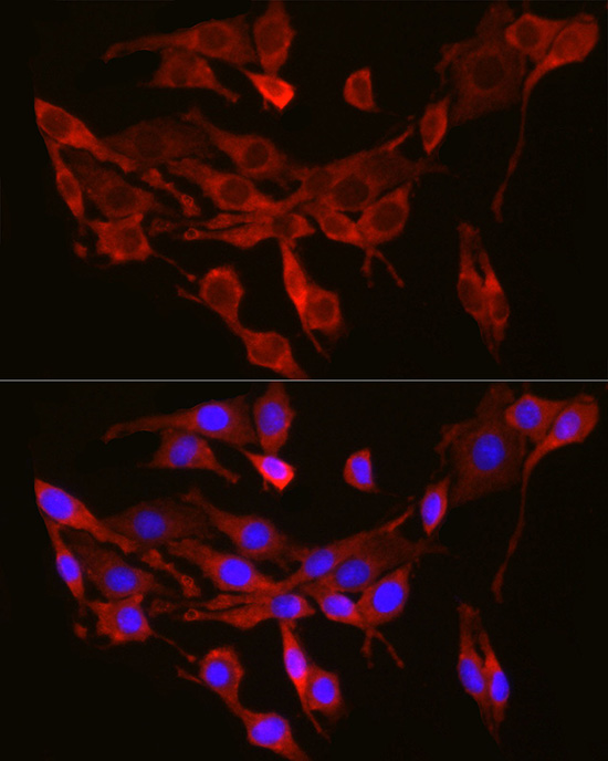 Immunofluorescence analysis of PC-12 cells using SEC61A1 Polyclonal Antibody at dilution of 1:300 (40x lens). Blue: DAPI for nuclear staining.