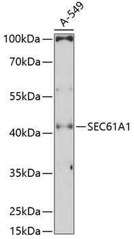 Western blot analysis of extracts of A-549 cells using SEC61A1 Polyclonal Antibody at 1:3000 dilution.