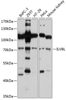 Western blot analysis of extracts of various cell lines using ILVBL Polyclonal Antibody at 1:3000 dilution.