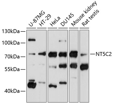 Western blot analysis of extracts of various cell lines using NT5C2 Polyclonal Antibody at 1:1000 dilution.