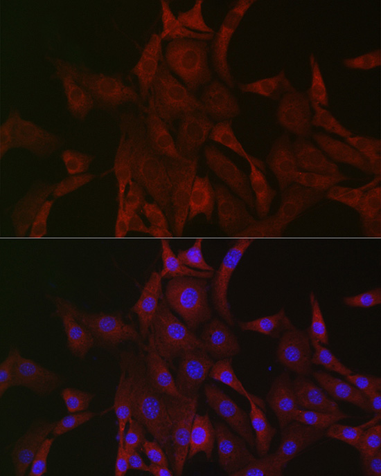 Immunofluorescence analysis of NIH/3T3 cells using PAK4 Polyclonal Antibody at dilution of 1:200 (40x lens). Blue: DAPI for nuclear staining.