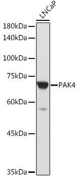 Western blot analysis of extracts of LNCaP cells using PAK4 Polyclonal Antibody at 1:1000 dilution.