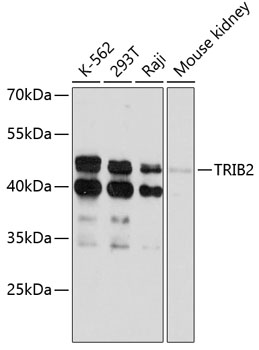 Western blot analysis of extracts of various cell lines using TRIB2 Polyclonal Antibody at 1:3000 dilution.