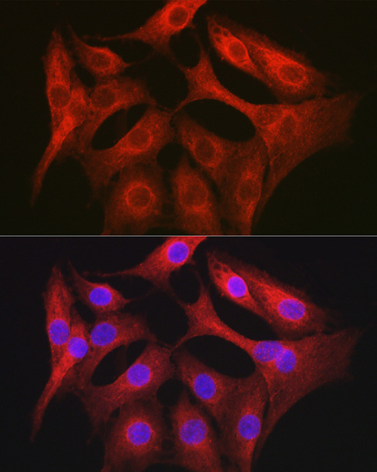 Immunofluorescence analysis of NIH/3T3 cells using OLA1 Polyclonal Antibody at dilution of 1:100 (40x lens). Blue: DAPI for nuclear staining.