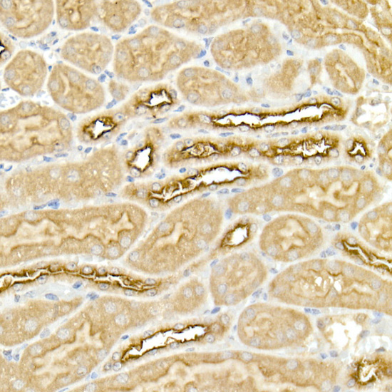 Immunohistochemistry of paraffin-embedded mouse kidney using SLC12A2 Polyclonal Antibody at dilution of 1:50 (40x lens).Perform high pressure antigen retrieval with 10 mM citrate buffer pH 6.0 before commencing with IHC staining protocol.