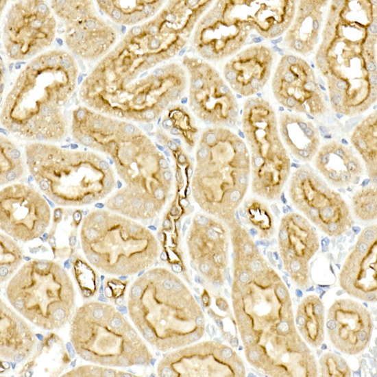 Immunohistochemistry of paraffin-embedded rat kidney using SLC12A2 Polyclonal Antibody at dilution of 1:50 (40x lens).Perform high pressure antigen retrieval with 10 mM citrate buffer pH 6.0 before commencing with IHC staining protocol.