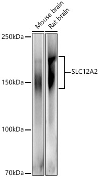 Western blot analysis of extracts of various cell lines using SLC12A2 Polyclonal Antibody at 1:500 dilution.