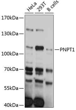 Western blot analysis of extracts of various cell lines using PNPT1 Polyclonal Antibody at 1:3000 dilution.