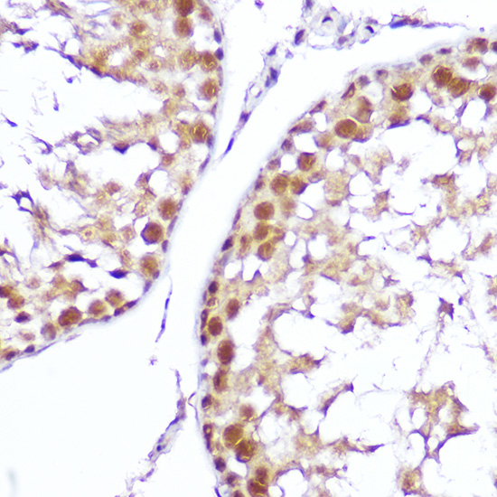 Immunohistochemistry of paraffin-embedded mouse testis using SMOX Polyclonal Antibody at dilution of 1:100 (40x lens).Perform high pressure antigen retrieval with 10 mM citrate buffer pH 6.0 before commencing with IHC staining protocol.