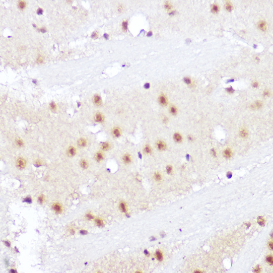 Immunohistochemistry of paraffin-embedded rat brain using SMOX Polyclonal Antibody at dilution of 1:100 (40x lens).Perform high pressure antigen retrieval with 10 mM citrate buffer pH 6.0 before commencing with IHC staining protocol.