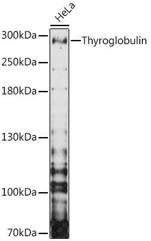 Western blot analysis of extracts of HeLa cells using Thyroglobulin Polyclonal Antibody at 1:3000 dilution.