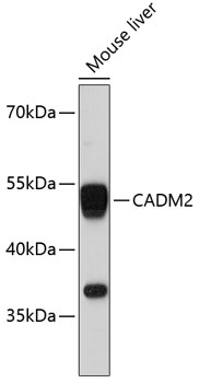 Western blot analysis of extracts of mouse liver using CADM2 Polyclonal Antibody at 1:3000 dilution.