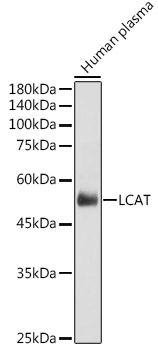 Western blot analysis of extracts of Human plasma using LCAT Polyclonal Antibody at 1:1000 dilution.