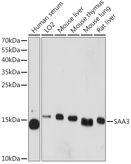 Western blot analysis of extracts of various cell lines using SAA3 Polyclonal Antibody at1:1000 dilution.