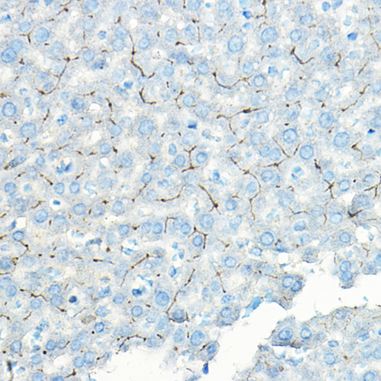 Immunohistochemistry of paraffin-embedded rat liver using LNPEP Polyclonal Antibody at dilution of 1:100 (40x lens).Perform high pressure antigen retrieval with 10 mM citrate buffer pH 6.0 before commencing with IHC staining protocol.