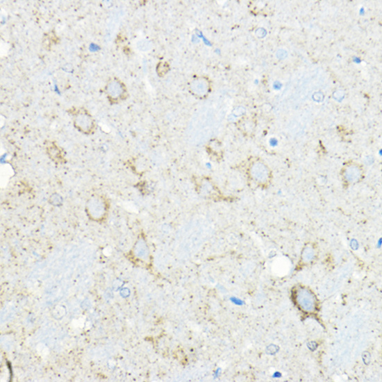 Immunohistochemistry of paraffin-embedded rat brain using LNPEP Polyclonal Antibody at dilution of 1:100 (40x lens).Perform high pressure antigen retrieval with 10 mM citrate buffer pH 6.0 before commencing with IHC staining protocol.