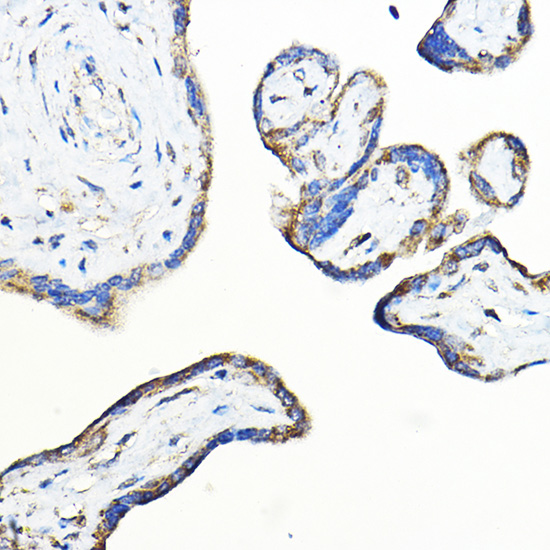 Immunohistochemistry of paraffin-embedded human placenta using LNPEP Polyclonal Antibody at dilution of 1:100 (40x lens).Perform high pressure antigen retrieval with 10 mM citrate buffer pH 6.0 before commencing with IHC staining protocol.