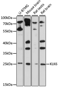 Western blot analysis of extracts of various cell lines using KLK6 Polyclonal Antibody at 1:1000 dilution.