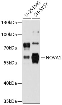 Western blot analysis of extracts of various cell lines using NOVA1 Polyclonal Antibody at 1:3000 dilution.