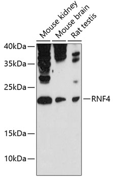 Western blot analysis of extracts of various cell lines using RNF4 Polyclonal Antibody at 1:3000 dilution.