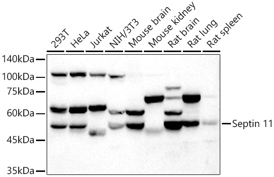 Western blot analysis of extracts of various cell lines using Septin 11 Polyclonal Antibody at 1:5000 dilution.