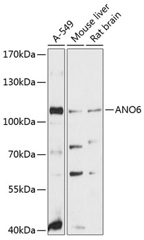 Western blot analysis of extracts of various cell lines using ANO6 Polyclonal Antibody at 1:3000 dilution.