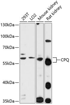 Western blot analysis of extracts of various cell lines using CPQ Polyclonal Antibody at 1:1000 dilution.