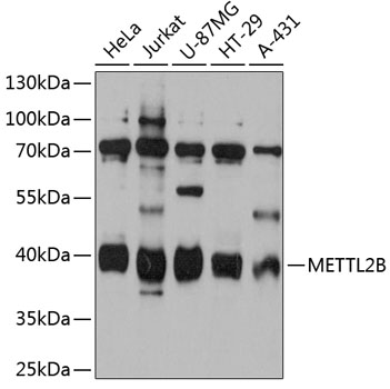 Western blot analysis of extracts of various cell lines using METTL2B Polyclonal Antibody at 1:3000 dilution.