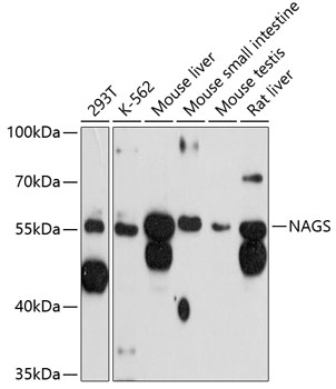 Western blot analysis of extracts of various cell lines using NAGS Polyclonal Antibody at 1:3000 dilution.