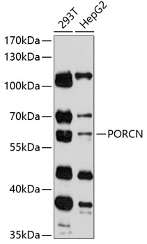 Western blot analysis of extracts of various cell lines using PORCN Polyclonal Antibody at 1:3000 dilution.